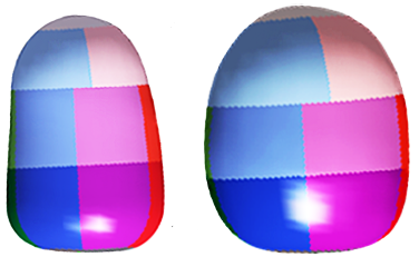 Comparison of Left Ventricle