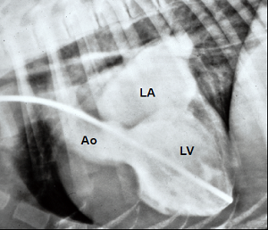 Angiocardiogram