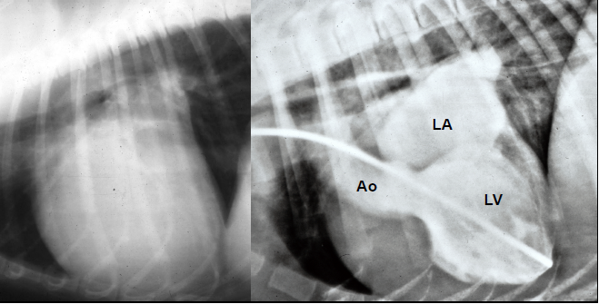 Angiogram comparison