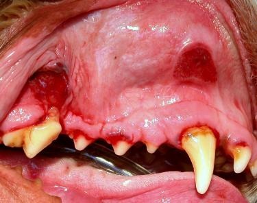 Stomatitis Ulcers