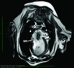 CMRI image of heart