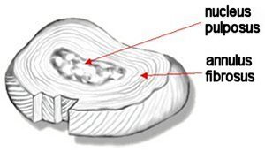 Intervertebral Disc