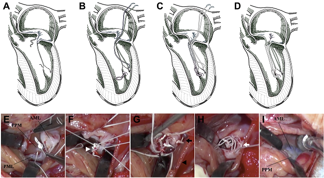 Fig. 1 -- Loop-to-loop