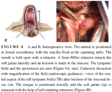 PSOM oral surgery