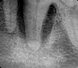 tooth x-ray